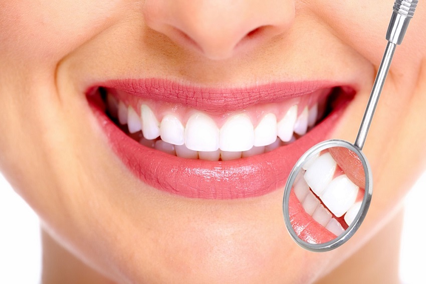The Top Benefits of Dental Implants